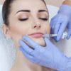 Tratamento Facial › Preenchimento labial: veja como é feito e em quais casos é indicado